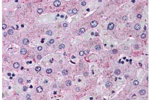 Immunohistochemistry (Formalin/PFA-fixed paraffin-embedded sections) of human liver tissue with GCGR polyclonal antibody .