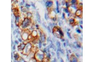 Used in DAB staining on fromalin fixed paraffin-embedded Ovary tissue (VTCN1 Antikörper  (AA 153-241))