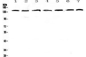 Western blot analysis of PERK using anti-PERK antibody . (PERK Antikörper  (AA 222-334))