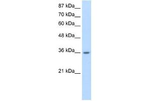 RP11-78J21. (HNRNPA1L2 Antikörper  (N-Term))