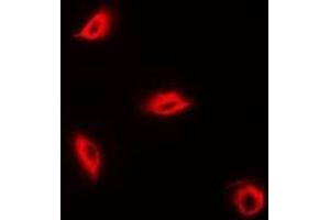 Immunofluorescent analysis of Perforin 1 staining in K562 cells. (Perforin 1 Antikörper)