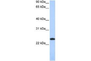 Western Blotting (WB) image for anti-Ferritin, Light Polypeptide (FTL) antibody (ABIN2459726) (FTL Antikörper)