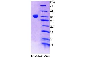 SDS-PAGE (SDS) image for Pyridoxamine 5'-Phosphate Oxidase (PNPO) (AA 1-261) protein (His tag) (ABIN6238760) (PNPO Protein (AA 1-261) (His tag))