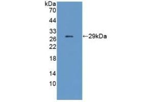 Detection of Recombinant CHRNe, Mouse using Polyclonal Antibody to Cholinergic Receptor, Nicotinic, Epsilon (CHRNe) (CHRNE Antikörper  (AA 21-239))