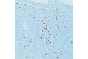 Immunohistochemical staining for paraffin-embedded human appendix section using Mast Cell Tryptase monoclonal antibody, clone 10D11 .