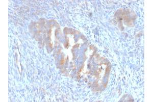 Immunohistochemistry (IHC) image for anti-ATG5 Autophagy Related 5 (ATG5) (AA 1-119) antibody (ABIN6941155)
