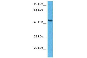 Host:  Rabbit  Target Name:  CD36  Sample Tissue:  Human HepG2 Whole Cell  Antibody Dilution:  1ug/ml