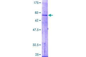 Acylglycerol Kinase Protein (AGK) (AA 1-422) (GST tag)