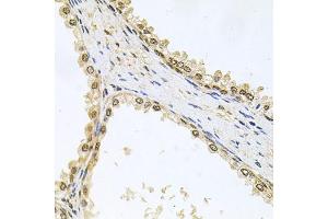 Immunohistochemistry of paraffin-embedded human prostate using MCL1 antibody (ABIN5970080) at dilution of 1/100 (40x lens). (MCL-1 Antikörper  (C-Term))