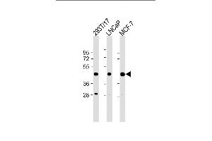 All lanes : Anti-PRMT6 (N-term) at 1:2000 dilution Lane 1: 293T/17 whole cell lysate Lane 2: LNCaP whole cell lysate Lane 3: MCF-7 whole cell lysate Lysates/proteins at 20 μg per lane. (PRMT6 Antikörper  (N-Term))