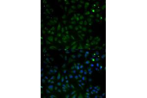 Immunofluorescence analysis of HeLa cells using VDAC1 antibody. (VDAC1 Antikörper  (AA 1-283))