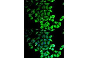 Immunofluorescence analysis of MCF-7 cell using RPS7 antibody. (RPS7 Antikörper)