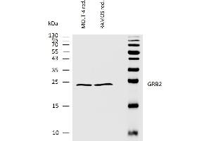 Western bloting analysis of human GRB2 using rabbit polyclonal antibody PAb (554) on lysates of MOLT-4 and RAMOS cell lines under reducing conditions. (GRB2 Antikörper  (AA 198-217))