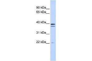 WB Suggested Anti-RABGGTB Antibody Titration:  0. (RABGGTB Antikörper  (Middle Region))