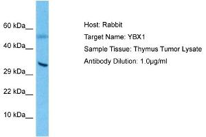Host: Rabbit Target Name: YBX1 Sample Type: Thymus Tumor lysates Antibody Dilution: 1. (YBX1 Antikörper  (C-Term))