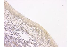 IHC analysis of SRCIN1 using anti-SRCIN1 antibody (ABIN6719623). (SRCIN1 Antikörper  (AA 189-287))