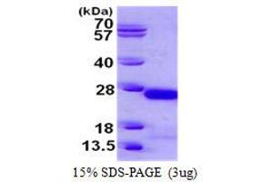 Image no. 1 for Crystallin, gamma C (CRYGC) protein (His tag) (ABIN1098275)