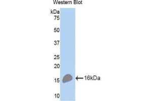 Western blot analysis of the recombinant protein. (BCMA Antikörper  (AA 71-184))