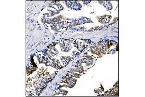 IHC analysis of Prolyl Endopeptidase/PREP using anti-Prolyl Endopeptidase/PREP antibody (ABIN7599118). (PREP Antikörper  (AA 1-227))