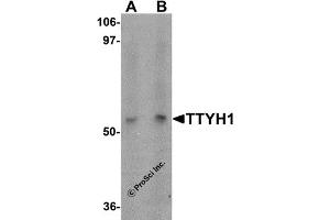 Western Blotting (WB) image for anti-Tweety Homolog 1 (TTYH1) (C-Term) antibody (ABIN1030786) (TTYH1 Antikörper  (C-Term))