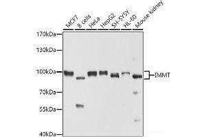 Western blot analysis of extracts of various cell lines using IMMT Polyclonal Antibody at dilution of 1:1000. (IMMT Antikörper)