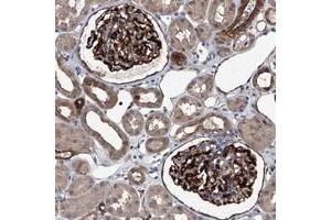 Immunohistochemical staining of human kidney with LDLRAD2 polyclonal antibody  shows distinct cytoplasmic and membranous positivity in cells in glomeruli at 1:200-1:500 dilution. (LDLRAD2 Antikörper)