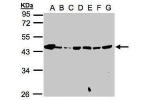 WB Image Sample(30μg whole cell lysate) A: 293T B: A431 , C: H1299 D: HeLa S3 , E: Hep G2 , F: MOLT4 , G: Raji , 10% SDS PAGE antibody diluted at 1:1000 (MPI Antikörper)