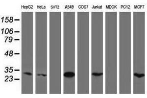 Image no. 4 for anti-Mitochondrial Translational Initiation Factor 3 (MTIF3) (AA 56-278) antibody (ABIN1491591) (MTIF3 Antikörper  (AA 56-278))