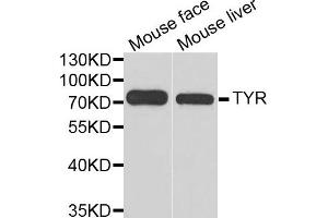 Western blot analysis of extracts of mouse face and mouse liver  tissues, using TYR antibody. (TYR Antikörper)