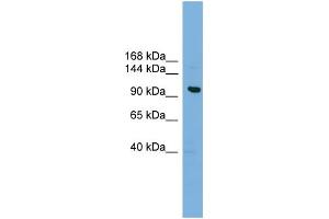 WB Suggested Anti-VPS41 Antibody Titration: 0. (VPS41 Antikörper  (Middle Region))