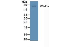 Figure. (BMPR2 Antikörper  (AA 27-150))