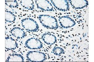 Immunohistochemical staining of paraffin-embedded Kidney tissue using anti-CHEK2mouse monoclonal antibody. (CHEK2 Antikörper)