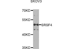 Western blot analysis of extracts of SKOV3 cells, using SRSF4 antibody (ABIN5974197) at 1/1000 dilution. (SRSF4 Antikörper)