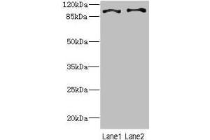 Western blot All lanes: CCP110 antibody at 4. (CP110 Antikörper  (AA 1-280))