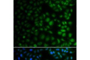 Immunofluorescence analysis of A549 cells using NAA40 Polyclonal Antibody (NAA40 Antikörper)