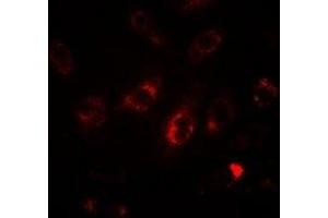 Immunofluorescent analysis of LC3A staining in HepG2 cells. (MAP1LC3A Antikörper)