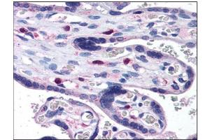 Human Placenta: Formalin-Fixed, Paraffin-Embedded (FFPE) (SNX16 Antikörper  (N-Term))