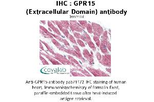 Image no. 1 for anti-G Protein-Coupled Receptor 15 (GPR15) (2nd Extracellular Domain) antibody (ABIN1734958) (GPR15 Antikörper  (2nd Extracellular Domain))