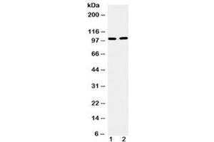 Western blot testing of 1) mouse testis and 2) human U87 cell lysate with TACC1 antibody at 0.