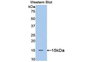 Western blot analysis of the recombinant protein. (Betacellulin Antikörper  (AA 32-118))