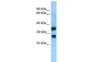 Host:  Rabbit  Target Name:  Aqp8  Sample Type:  Rat Small Intestine lysates  Antibody Dilution:  1.