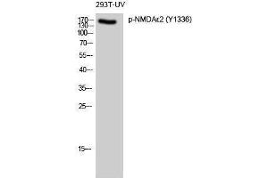 Western Blotting (WB) image for anti-NMDA epsilon 2 (pTyr1336) antibody (ABIN3182688) (NMDA epsilon 2 (pTyr1336) Antikörper)