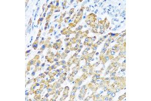 Immunohistochemistry of paraffin-embedded human liver using LRPPRC antibody at dilution of 1:100 (40x lens). (LRPPRC Antikörper)