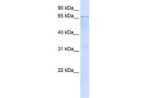 WB Suggested Anti-OPTN Antibody Titration:  0. (OPTN Antikörper  (N-Term))