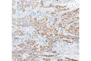 IHC analysis of Cytokeratin 20/Krt20 using anti-Cytokeratin 20/Krt20 antibody (ABIN7601133). (KRT20 Antikörper  (AA 29-431))