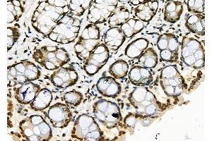 ABIN6256824 and ABIN6273425 at 1/100 staining Rat stomach tissue by IHC-P. (ATRAID Antikörper  (Internal Region))