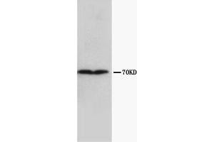 Western Blotting (WB) image for anti-Collagen, Type III, alpha 1 (COL3A1) (Chain alpha 1) antibody (ABIN1106750) (COL3A1 Antikörper  (Chain alpha 1))