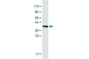 Western Blot detection against Immunogen (36. (CYP7A1 Antikörper  (AA 179-277))