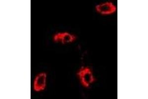 Immunofluorescent analysis of RAB11A staining in MCF7 cells. (RAB11A Antikörper)