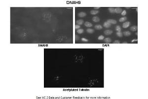 Immunohistochemistry (IHC) image for anti-Dynein, Axonemal, Heavy Chain 9 (DNAH9) (C-Term) antibody (ABIN2790246) (DNAH9 Antikörper  (C-Term))